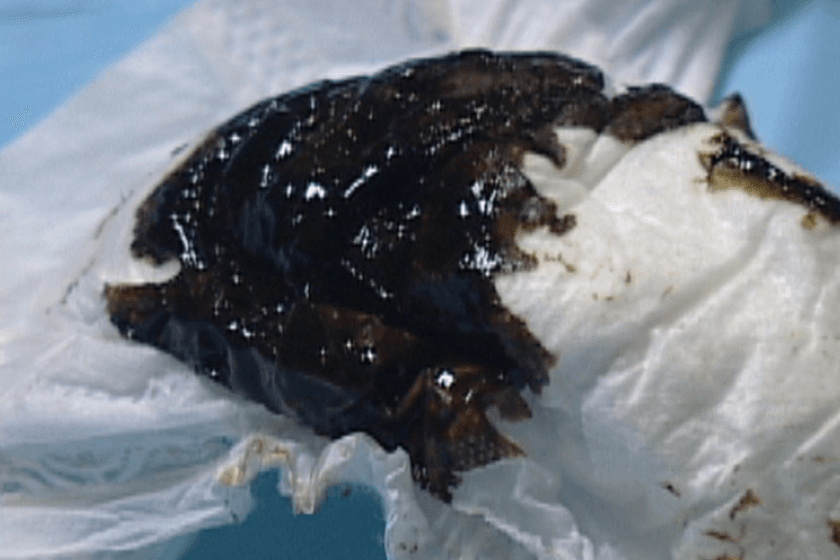Why does my newborn have black poop?