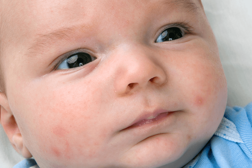 Is this normal? Common conditions in newborn